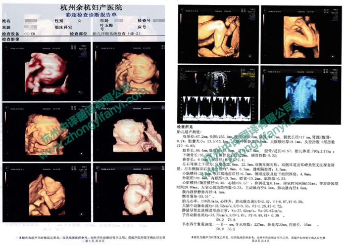 婴儿多普勒彩照B超单中译英翻译件模板及注意事项.jpg